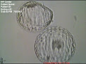 Your fertility clinic Ivf1 - Dr. Randy S. Morris M.d in Plainfield in Illinois